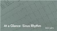 At a Glance: Sinus Rhythm