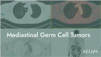 Mediastinal Germ Cell Tumors