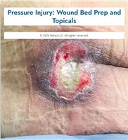 Pressure Injury: Wound Bed Prep and Topicals