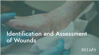 Identification and Assessment of Wounds