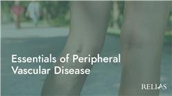 Essentials of Peripheral Vascular Disease