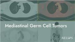 Mediastinal Germ Cell Tumors