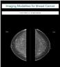 Imaging Modalities for Breast Cancer